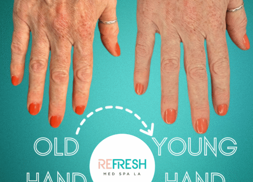 before after hand rejuvenation
