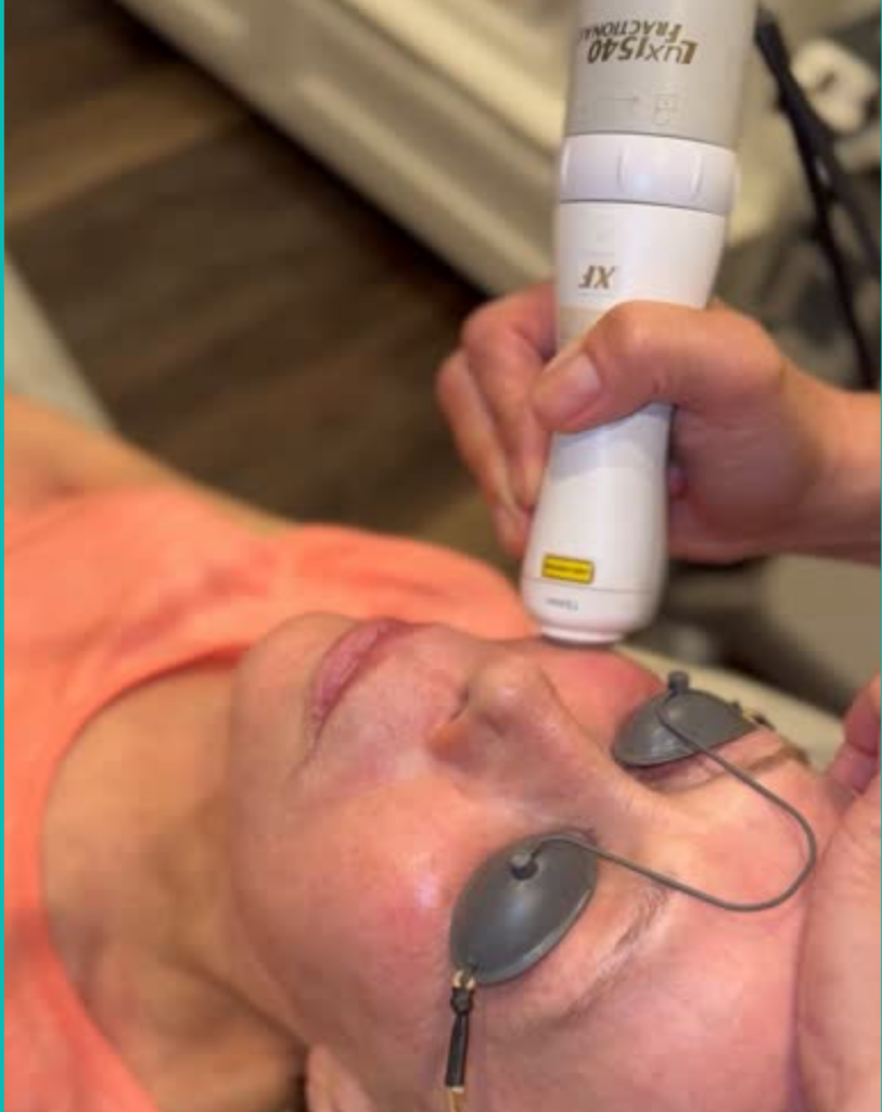 laser on womans face